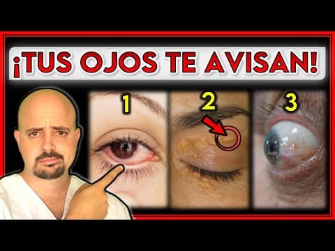7 señales en tus ojos que revelan problemas de salud importantes